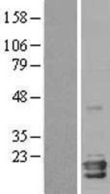 Western Blot: Neuroglobin Overexpression Lysate (Adult Normal) [NBL1-13631] Left-Empty vector transfected control cell lysate (HEK293 cell lysate); Right -Over-expression Lysate for Neuroglobin.