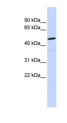 Western Blot: Neuroglycan-C Antibody [NBP1-59341] - MCF-7 whole cell lysates, concentration 0.2-1 ug/ml.
