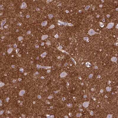 Immunohistochemistry-Paraffin: Neuroglycan C/CSPG5 Antibody [NBP2-49669] - Staining of human cerebral cortex shows high expression.