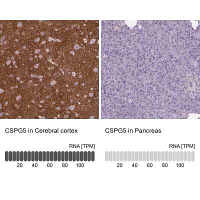 Immunohistochemistry-Paraffin Neuroglycan C/CSPG5 Antibody - BSA Free