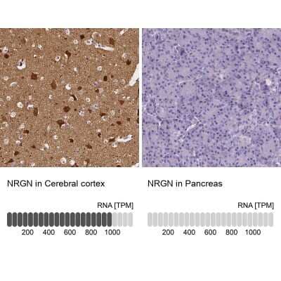 <b>Orthogonal Strategies Validation. </b>Immunohistochemistry-Paraffin: Neurogranin Antibody [NBP2-32655] - Analysis in human cerebral cortex and pancreas tissues. Corresponding Neurogranin RNA-seq data are presented for the same tissues.