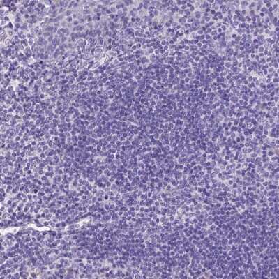 Immunohistochemistry-Paraffin: Neurogranin Antibody [NBP2-32655] - Staining of human lymphoid tissues shows no positivity in germinal center cells as expected.