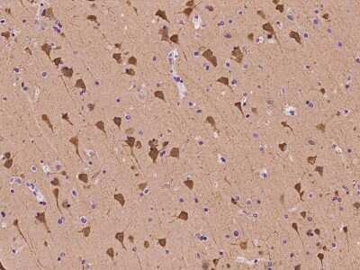 Immunohistochemistry-Paraffin: Neurogranin Antibody [NBP2-97430] - Immunochemical staining of human Neurogranin in human brain with rabbit polyclonal antibody at 1:100 dilution, formalin-fixed paraffin embedded sections.