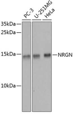 Western Blot: Neurogranin Antibody [NBP2-94659] - Analysis of extracts of various cell lines, using Neurogranin at 1:1000 dilution.Secondary antibody: HRP Goat Anti-Rabbit IgG (H+L) at 1:10000 dilution.Lysates/proteins: 25ug per lane.Blocking buffer: 3% nonfat dry milk in TBST.Detection: ECL Basic Kit .Exposure time: 90s.