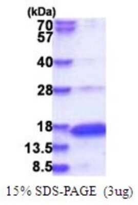 SDS-Page: Recombinant Human Neurogranin Protein [NBP2-51746] -  15% SDS Page (3 ug)