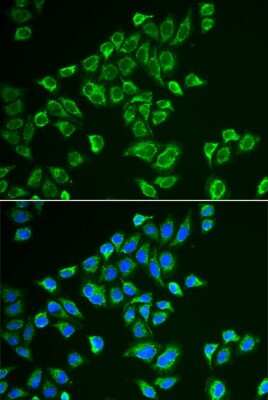 Immunocytochemistry/Immunofluorescence: Neurokinin B Antibody [NBP2-93826] - Immunofluorescence analysis of HeLa cells using Neurokinin B antibody (NBP2-93826). Blue: DAPI for nuclear staining.