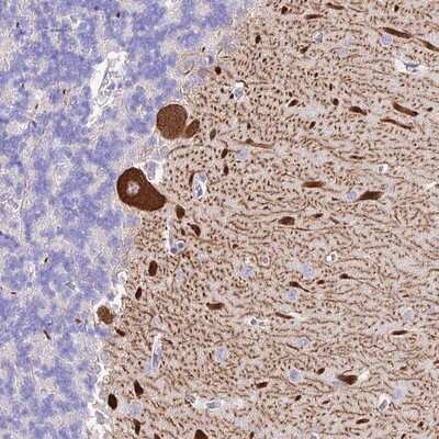 Immunohistochemistry-Paraffin: Neurokinin B Antibody [NBP1-92178] - Staining of human cerebellum shows strong cytoplasmic positivity in purkinje cells.