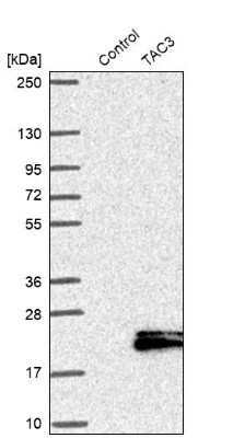 Western Blot: Neurokinin B Antibody [NBP1-92178] - Analysis in control (vector only transfected HEK293T lysate) and TAC3 over-expression lysate (Co-expressed with a C-terminal myc-DDK tag (3.1 kDa) in mammalian HEK293T cells).