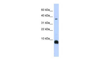 Western Blot: Neurokinin B Antibody [NBP2-85377] - WB Suggested Anti-TAC3 Antibody Titration: 0.2-1 ug/ml. ELISA Titer: 1:1562500. Positive Control: Human brain