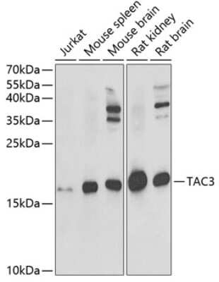 Western Blot: Neurokinin B Antibody [NBP2-93826] - Analysis of extracts of various cell lines, using Neurokinin B . Exposure time: 20s.