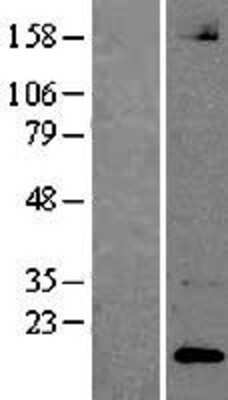 Western Blot: Neuroligin 1 Overexpression Lysate (Adult Normal) [NBP2-04347] Left-Empty vector transfected control cell lysate (HEK293 cell lysate); Right -Over-expression Lysate for Neuroligin 1.