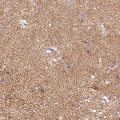 Immunohistochemistry-Paraffin: Neuroligin 2/NLGN2 Antibody [NBP2-49590] - Staining of human cerebral cortex shows high expression.