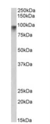 Western Blot: Neuroligin 2/NLGN2 Antibody [NBP1-00220] - Staining of Human Pancrease lysate (35 ug protein in RIPA buffer). Antibody at 2 ug/mL. Detected by chemiluminescence.