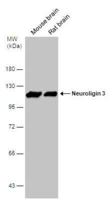 Western Blot: Neuroligin 3/NLGN3 Antibody [NBP3-12987] - Various tissue extracts (50 ug) were separated by 7.5% SDS-PAGE, and the membrane was blotted with Neuroligin 3/NLGN3 antibody (NBP3-12987) diluted at 1:10000.