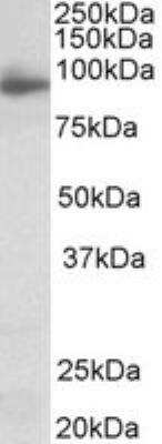 Western Blot Neuroligin 4X/NLGN4X Antibody