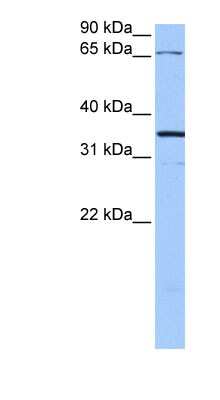 Western Blot: Neuroligin 4 X-Linked Antibody [NBP1-59255] - Hela cell lysate, concentration 0.2-1 ug/ml.