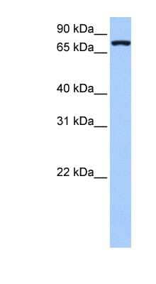 Western Blot: Neuroligin 4 X-Linked Antibody [NBP1-59256] - Hela cell lysate, concentration 0.2-1 ug/ml.