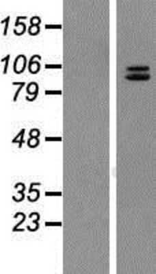 Western Blot: Neuroligin 4 Y-Linked Overexpression Lysate (Adult Normal) [NBP2-10303] Left-Empty vector transfected control cell lysate (HEK293 cell lysate); Right -Over-expression Lysate for Neuroligin 4 Y-Linked.