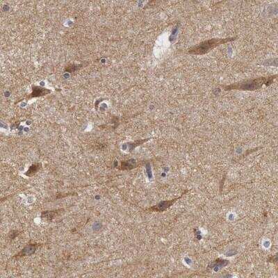 Immunohistochemistry: Neuroligin 4X/NLGN4X Antibody [NBP1-89684] - Staining of human cerebral cortex shows moderate cytoplasmic positivity in neuronal cells.