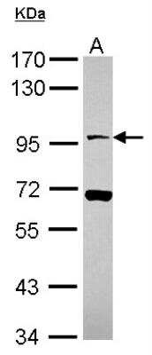 Western Blot: Neuroligin 4X/NLGN4X Antibody [NBP2-19521] - Sample (30 ug of whole cell lysate) A: A549 7. 5% SDS PAGE gel, diluted at 1:1000.