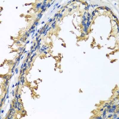 Immunohistochemistry-Paraffin Neuroligin 4Y/NLGN4Y Antibody - BSA Free