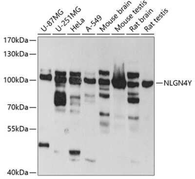 Western Blot Neuroligin 4Y/NLGN4Y Antibody - BSA Free