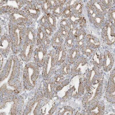 Immunohistochemistry-Paraffin: Neurolysin Antibody [NBP1-89198] - Staining of human stomach shows moderate granular cytoplasmic positivity in glandular cells.