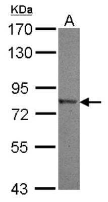 Western Blot: Neurolysin Antibody [NBP2-19547] - Sample (30 ug of whole cell lysate) A: NT2D1 7. 5% SDS PAGE gel, diluted at 1:500.