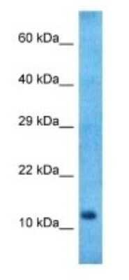 Western Blot: Neuromedin B Antibody [NBP3-09269] - Western blot analysis of Neuromedin B in Stomach Tumor lysates. Antibody dilution at 1.0ug/ml