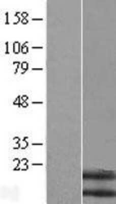 Western Blot: Neuromedin B Overexpression Lysate (Adult Normal) [NBL1-13679] Left-Empty vector transfected control cell lysate (HEK293 cell lysate); Right -Over-expression Lysate for Neuromedin B.