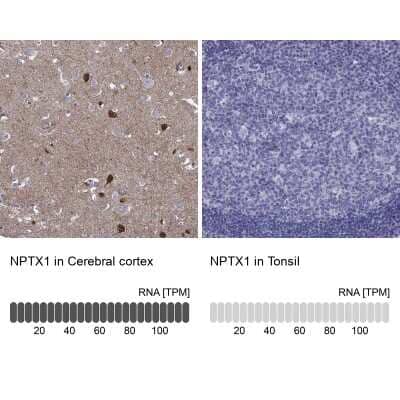 <b>Orthogonal Strategies Validation. </b>Immunohistochemistry-Paraffin: Neuronal Pentraxin 1 Antibody [NBP2-62710] - Analysis in human cerebral cortex and tonsil tissues using Anti-NPTX1 antibody. Corresponding NPTX1 RNA-seq data are presented for the same tissues.