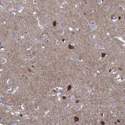 Immunohistochemistry-Paraffin: Neuronal Pentraxin 1 Antibody [NBP2-62710] - Staining of human cerebral cortex shows high expression.