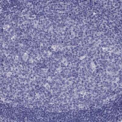 Immunohistochemistry-Paraffin: Neuronal Pentraxin 1 Antibody [NBP2-62710] - Staining of human tonsil shows low expression as expected.