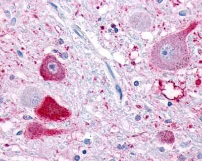Immunohistochemistry-Paraffin: Neuropeptide FF R1/NPFFR1 Antibody [NLS1903] - Analysis of anti-NPFF1 Receptor antibody with human brain, neurons at 19 ug/ml.