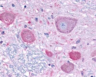 Immunohistochemistry-Paraffin: Neuropeptide FF R1/NPFFR1 Antibody [NLS1905] - Analysis of anti-NPFF1 Receptor antibody with human brain, neurons at 20 ug/ml.