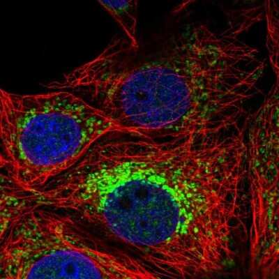 Immunocytochemistry/Immunofluorescence: Neuroplastin Antibody [NBP2-47357] - Staining of human cell line MCF7 shows localization to nucleoplasm, mitochondria & cytokinetic bridge.