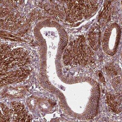 Immunohistochemistry-Paraffin: Neuroplastin Antibody [NBP2-56293] - Staining of human endometrium shows strong membranous positivity in glandular cells.