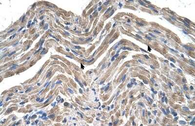 Immunohistochemistry-Paraffin: Neuroplastin Antibody [NBP1-62423] - Human Muscle Tissue, Skeletal muscle cells (Indicated with Arrows) 4-8ug/ml.