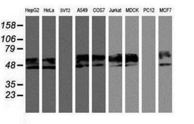 Western Blot: Neuroplastin Antibody (OTI3C4) - Azide and BSA Free [NBP2-72966] - Analysis of extracts (35ug) from 9 different cell lines by using anti-NPTN monoclonal antibody.