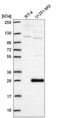 Western Blot: Neuroplastin Antibody [NBP2-56293] - Analysis in human cell line RT-4 and human cell line U-251 MG.