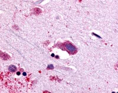 Immunohistochemistry-Paraffin: Neurotensin Receptor 1 Antibody [NLS939] - Analysis of anti-NTSR1 antibody with human brain, neurons and glia.