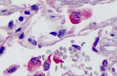 Immunohistochemistry-Paraffin: Neurotrypsin Antibody [NBP1-03232] - Staining of human lung. Immunohistochemistry of formalin-fixed, paraffin-embedded tissue after heat-induced antigen retrieval. Antibody concentration 5 ug/ml.