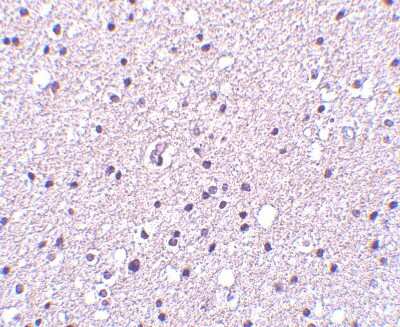 Immunohistochemistry-Paraffin Neurotrypsin Antibody - BSA Free