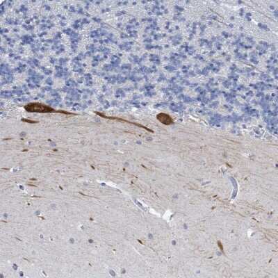 Immunohistochemistry-Paraffin Neurotrypsin Antibody