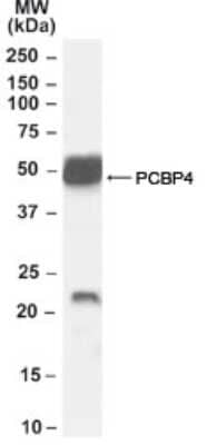 Western Blot: Neurturin Antibody [NB100-68153] - Analysis of Neurturin (mouse) antibody using this antibody at 0.1 ug/ml in mouse brain lysate.