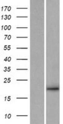 Western Blot: Neurturin Overexpression Lysate (Adult Normal) [NBP2-10529] Left-Empty vector transfected control cell lysate (HEK293 cell lysate); Right -Over-expression Lysate for Neurturin.