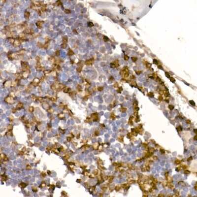 Immunohistochemistry-Paraffin: Neutrophil Elastase/ELA2 Antibody (8X4E6) [NBP3-16724] - Mouse bone marrow using Neutrophil Elastase/ELA2 antibody (NBP3-16724) at dilution of 1:100 (40x lens).Perform microwave antigen retrieval with 10 mM Tris/EDTA buffer pH 9.0 before commencing with IHC staining protocol.