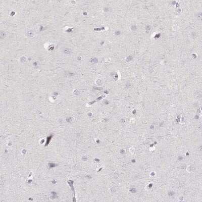 <b>Orthogonal Strategies Validation. </b>Immunohistochemistry-Paraffin: Neutrophil Elastase/ELA2 Antibody [NBP2-57576] - Staining of human cerebral cortex shows low expression as expected.