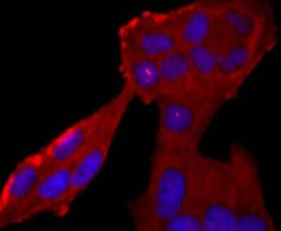 Immunocytochemistry/Immunofluorescence: Neutrophil Elastase/ELA2 Antibody (JF098-6) [NBP2-66972] - Staining Neutrophil Elastase in Hela cells (red). The nuclear counter stain is DAPI (blue). Cells were fixed in paraformaldehyde, permeabilised with 0.25% Triton X100/PBS.