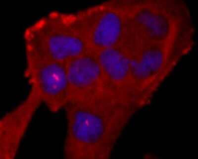 Immunocytochemistry/Immunofluorescence: Neutrophil Elastase/ELA2 Antibody (JF098-6) [NBP2-66972] - ICC staining of Neutrophil Elastase in Hela cells (red). Formalin fixed cells were permeabilized with 0.1% Triton X-100 in TBS for 10 minutes at room temperature and blocked with 1% Blocker BSA for 15 minutes at room temperature. Cells were probed with the primary antibody (1/50) for 1 hour at room temperature, washed with PBS. Alexa Fluor®594 Goat anti-Rabbit IgG was used as the secondary antibody at 1/1,000 dilution. The nuclear counter stain is DAPI (blue).